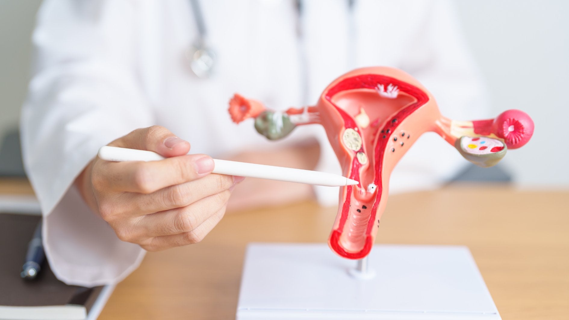 Was sind Anzeichen für Endometriose? - Periodenunterwäsche, Menstruationsunterwäsche von my•mense